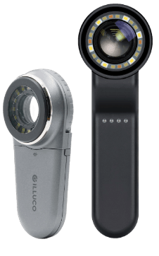 Dermatoscope